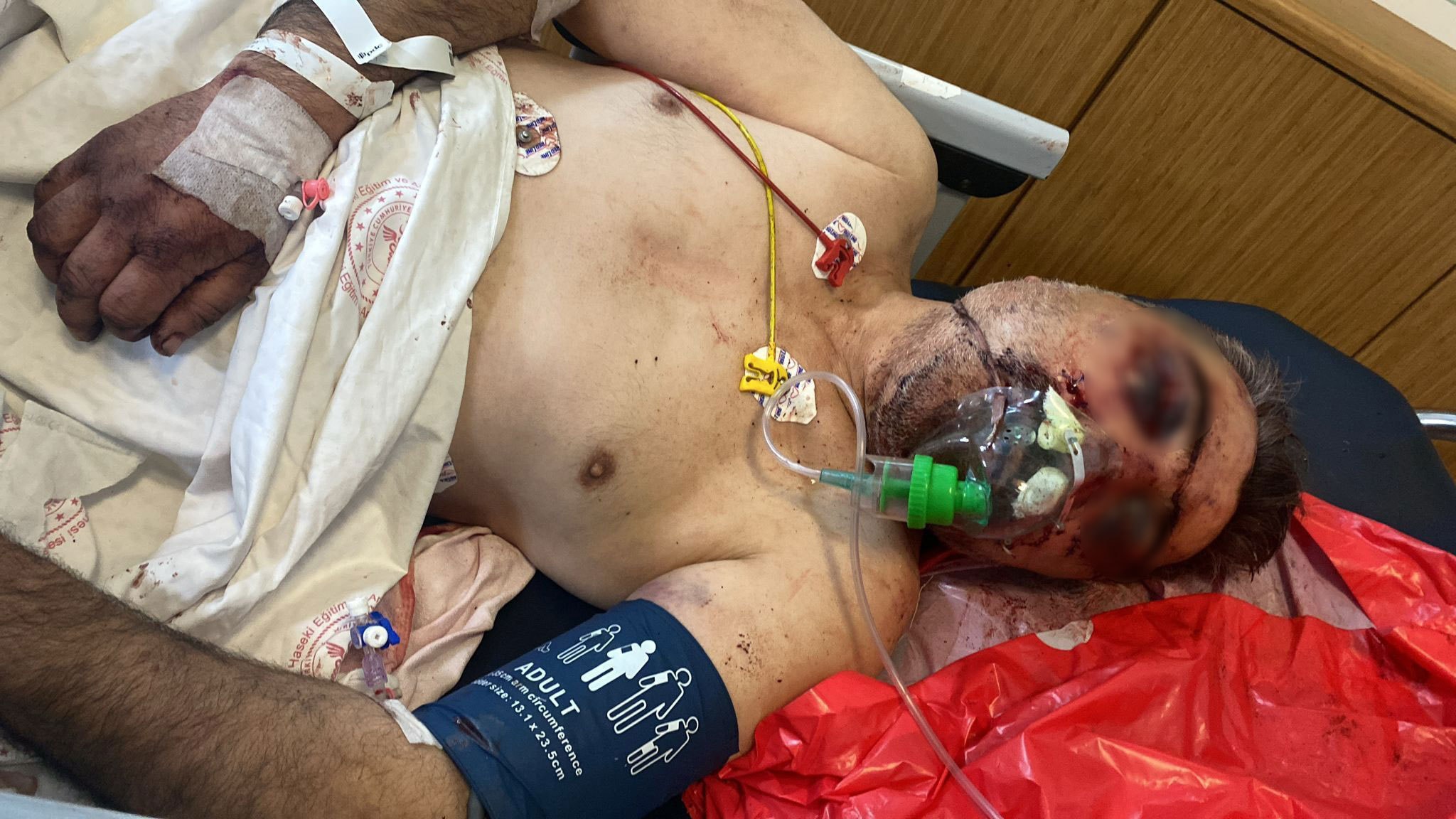 BRIT BOXER - Englishman Arrested After Leaving Istanbul Taxi Driver 'In A Coma' - Article cover image