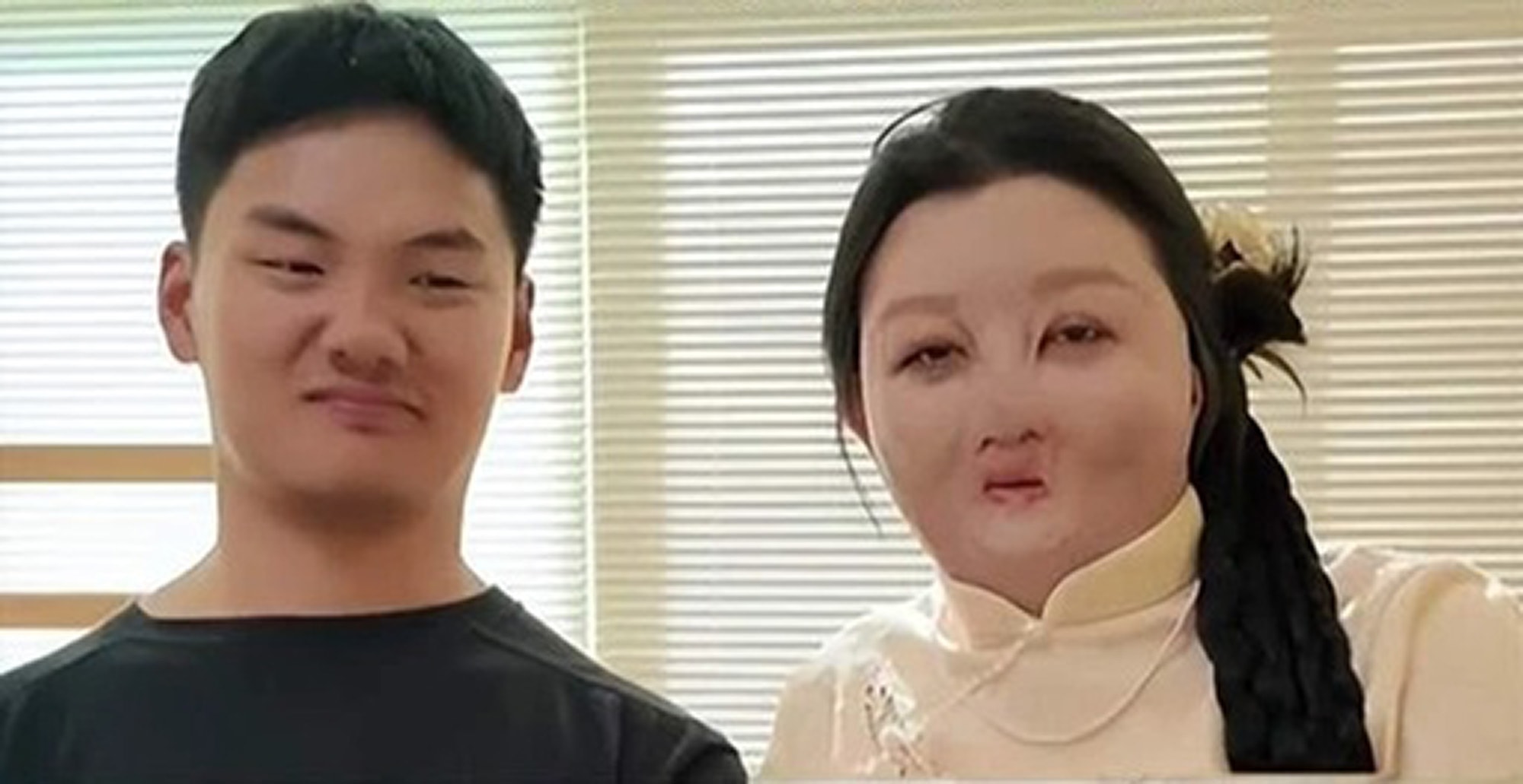 FATE DATE - Woman Left With Huge Scars From House Fire Says New Love Was Her Destiny - Article cover image