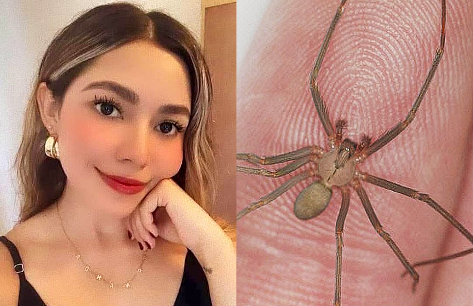 DEADLY SPIDER BITE DISSOLVED FLESH - Brown Recluse Venom 10x More Powerful Than Sulphuric Acid - Article cover image