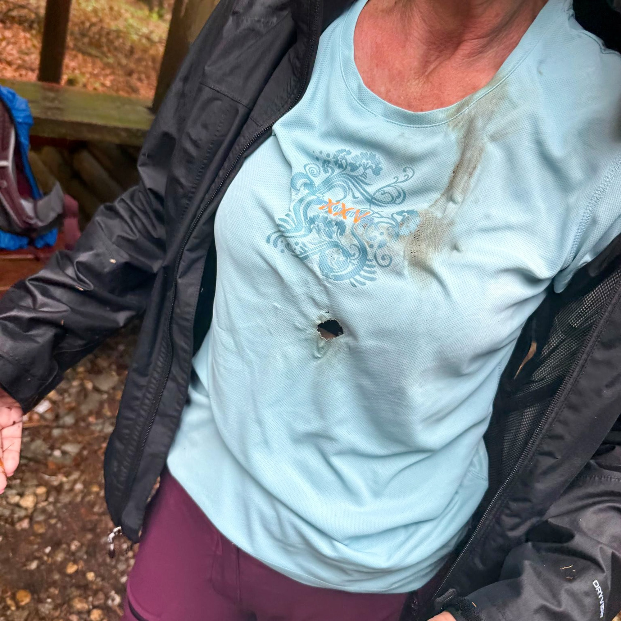 HOLE LOT OF BOTHER - Lightning Strike Leaves Blacked Mark On Woman Hiker's T-Shirt - Article cover image