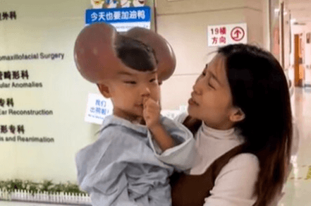 MY 'MICKEY MOUSE' SON JOY - Proud Mum Shows Off Cruelly Taunted Boy After Op - Article cover image