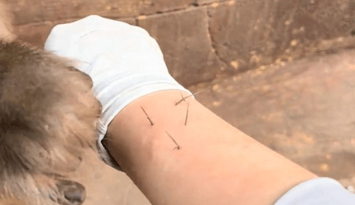 THORNY PROBLEM - Monkey Helps Woman By Plucking Thorns From Her Arm - Article cover image