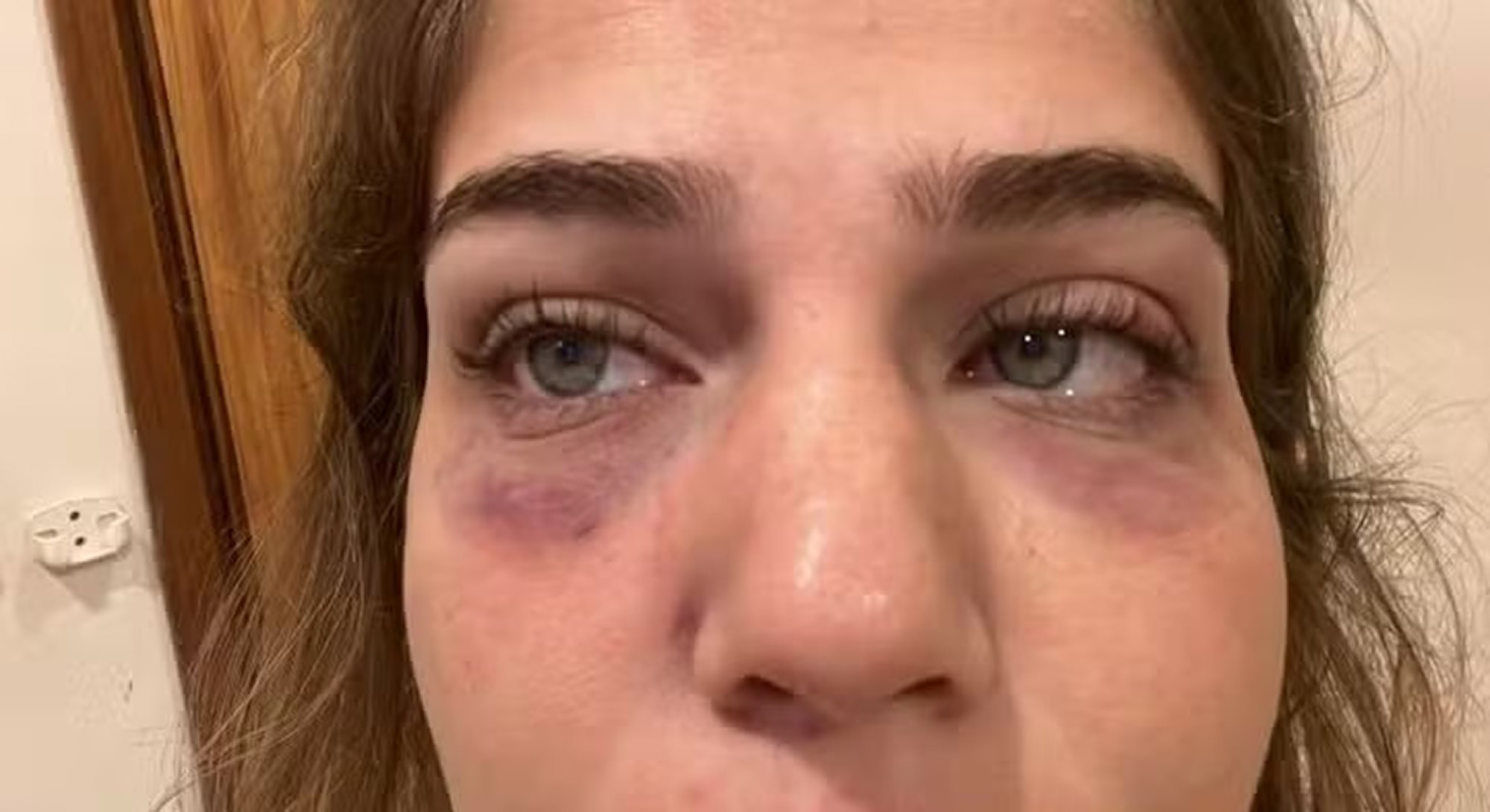 SEX SLAVE – Influencer 'Locked Up And Abused' By Football Player Before She Fled To Safety - Article cover image