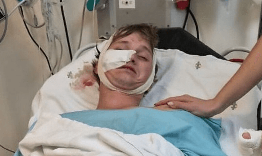 NOTHING TO LAUGH ABOUT β Stag Party Guest Fights Off Hyenas With Bare Hands At Game Reserve - Article cover image