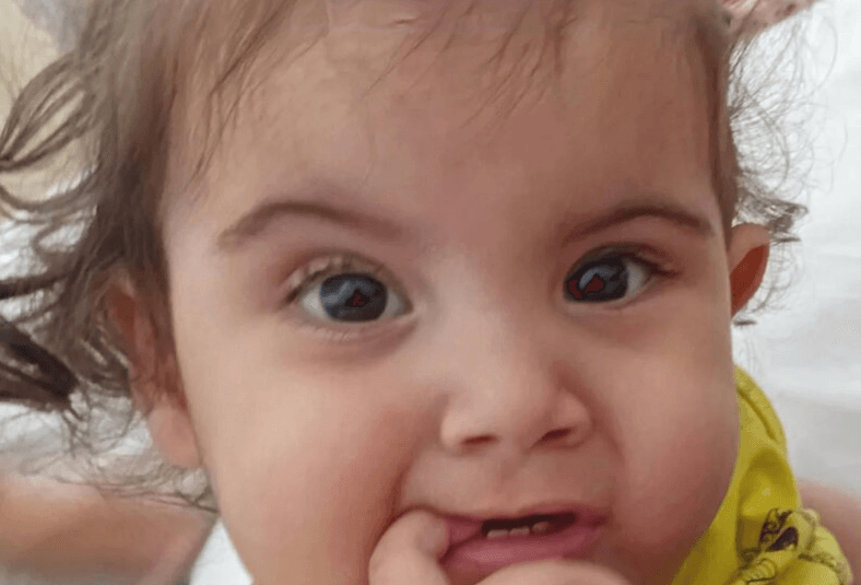 TWINS HEARTBREAK - Conjoined Tot Dies After Marathon Op To Separate Sisters - Article cover image